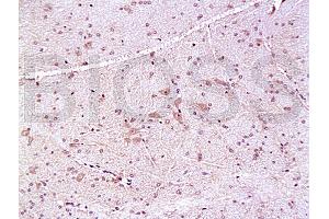 Formalin-fixed and paraffin embedded: rat brain tissue labeled with Anti-PMP22 Polyclonal Antibody, Unconjugated (ABIN726680) at 1:200, followed by conjugation to the secondary antibody and DAB staining (PMP22 抗体  (AA 101-160))