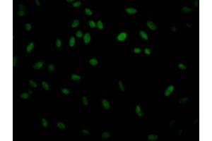 Immunofluorescence (IF) image for anti-Inhibitor of kappa Light Polypeptide Gene Enhancer in B-Cells, Kinase beta (IKBKB) antibody (ABIN7127566)