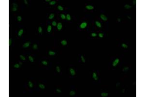 Immunofluorescence staining of Hela Cells with ABIN7127566 at 1:50, counter-stained with DAPI. (Recombinant IKBKB 抗体)