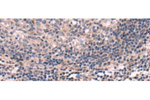 Immunohistochemistry of paraffin-embedded Human tonsil tissue using KCNT1 Polyclonal Antibody at dilution of 1:30(x200) (KCNT1 抗体)