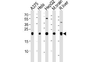 Western blot analysis of lysates from , Hela, HepG2 cell line, mouse brain and rat liver tissue lysate(from left to right), using IT Antibody (N-term) (ABIN651135 and ABIN2840091). (ITPA 抗体  (N-Term))