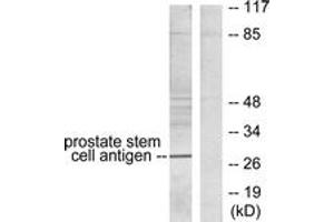 Western blot analysis of extracts from HepG2 cells, using Prostate Stem Cell Antigen Antibody. (PSCA 抗体  (AA 41-90))