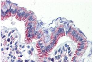 Human Colon (formalin-fixed, paraffin-embedded) stained with IMPDH1 antibody ABIN462258 followed by biotinylated goat anti-rabbit IgG secondary antibody ABIN481713, alkaline phosphatase-streptavidin and chromogen.