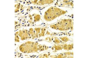 Immunohistochemistry of paraffin-embedded Human gastric using PRKAA1 antibody at dilution of 1:100 (x400 lens). (PRKAA1 抗体  (AA 1-300))