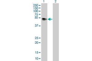 Lane 1: F2R transfected lysate ( 46. (F2R 293T Cell Transient Overexpression Lysate(Denatured))