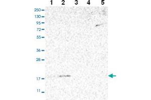 Western blot analysis of Lane 1: RT-4 Lane 2: U-251 MG Lane 3: Human Plasma Lane 4: Liver Lane 5: Tonsil with MRPS24 polyclonal antibody ( Cat # PAB28022 ) at 1:100 - 1:250 dilution.