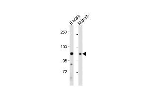 All lanes : Anti-EphA4 Antibody (C-term) at 1:2000 dilution Lane 1: Human brain tissue lysate Lane 2: Mouse brain tissue lysate Lysates/proteins at 20 μg per lane. (EPH Receptor A4 抗体  (C-Term))