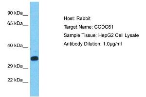 Host: Rabbit Target Name: CCDC61 Sample Type: HepG2 Whole Cell lysates Antibody Dilution: 1. (CCDC61 抗体  (C-Term))