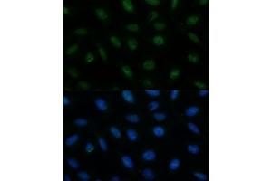 Immunofluorescence analysis of U-2 OS cells using CENPA Polyclonal Antibody (ABIN7266271) at dilution of 1:100 (40x lens). (CENPA 抗体  (AA 1-100))