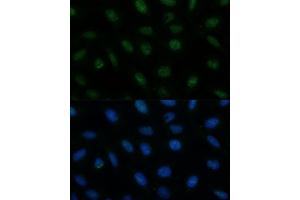 Immunofluorescence analysis of U-2 OS cells using CENPA Polyclonal Antibody (ABIN7266271) at dilution of 1:100 (40x lens). (CENPA 抗体  (AA 1-100))