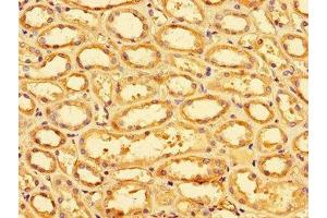 Immunohistochemistry of paraffin-embedded human kidney tissue using ABIN7170023 at dilution of 1:100 (SLC9A1 抗体  (AA 36-102))