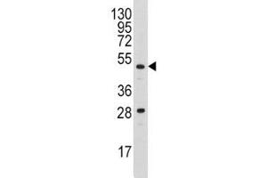 Western blot analysis of Urokinase antibody and A2058 lysate (PLAU 抗体  (AA 60-90))