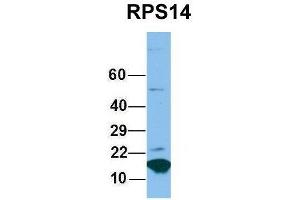 Host:  Rabbit  Target Name:  RPS14  Sample Type:  Hela  Antibody Dilution:  1. (RPS14 抗体  (Middle Region))