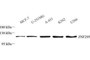Western blot analysis of ZNF295 (ABIN7076264) at dilution of 1: 500 (ZNF295 抗体)