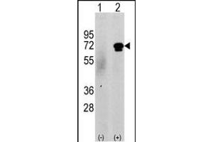 Western blot analysis of CKK2 (arrow) using rabbit polyclonal CKK2 Antibody (N-term G67) (ABIN391182 and ABIN2841279). (CAMKK2 抗体  (N-Term))