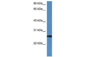 Western Blot showing Rab27b antibody used at a concentration of 1. (RAB27B 抗体  (C-Term))