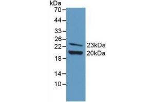 Detection of Recombinant FGF2, Mouse using Polyclonal Antibody to Fibroblast Growth Factor 2, Basic (FGF2) (FGF2 抗体  (AA 10-154))