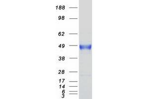 Western Blotting (WB) image for Carbonic Anhydrase 12 (CA12) (Transcript Variant 1) protein (Myc-DYKDDDDK Tag) (ABIN2713123)