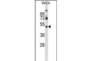 SUPT7L Antibody (Center) (ABIN1537989 and ABIN2848712) western blot analysis in WiDr cell line lysates (35 μg/lane). (SUPT7L 抗体  (AA 186-214))