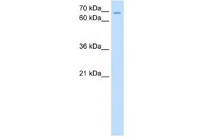 WB Suggested Anti-ZNF131 Antibody Titration:  0. (ZNF131 抗体  (N-Term))