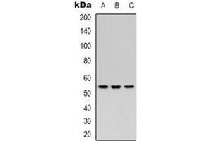 Western blot analysis of Secretogranin 3 expression in Hela (A), mouse heart (B), mouse kidney (C) whole cell lysates.
