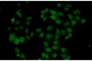 Immunofluorescence analysis of U2OS cells using FGF14 Polyclonal Antibody (FGF14 抗体)