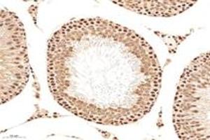Immunohistochemistry analysis of paraffin-embedded mouse testis using,MCM4 (ABIN7074631) at dilution of 1: 2400 (MCM4 抗体)