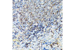 Immunohistochemistry of paraffin-embedded rat spleen using CORO1A Rabbit pAb (ABIN6133495, ABIN6138903, ABIN6138904 and ABIN6224969) at dilution of 1:100 (40x lens). (Coronin 1a 抗体  (AA 362-461))