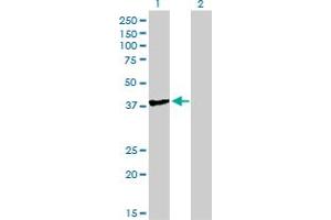 Western Blot analysis of TCEA3 expression in transfected 293T cell line by TCEA3 monoclonal antibody (M07), clone 3B9.
