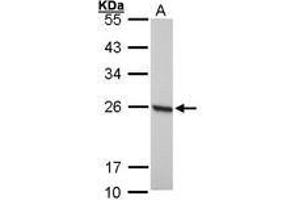 Image no. 1 for anti-Peroxiredoxin 1 (PRDX1) (AA 19-116) antibody (ABIN467365) (Peroxiredoxin 1 抗体  (AA 19-116))