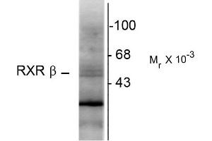 Western blots of hippocampal lysate showing specific immunolabeling of the ~48k RXR-ß protein. (Retinoid X Receptor beta 抗体)