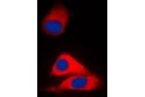 Immunofluorescent analysis of MVK staining in HepG2 cells. (MVK 抗体)
