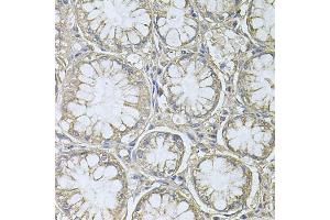 Immunohistochemistry (IHC) image for anti-Protein Tyrosine Phosphatase Type IVA, Member 3 (PTP4A3) (AA 1-148) antibody (ABIN1682391)