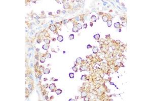 Immunohistochemistry (IHC) image for anti-Second Mitochondria-Derived Activator of Caspase (DIABLO) (AA 1-232) antibody (ABIN3023379)