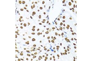 Immunohistochemistry (Paraffin-embedded Sections) (IHC (p)) image for anti-KH Domain Containing, RNA Binding, Signal Transduction Associated 1 (KHDRBS1) (C-Term) antibody (ABIN6142829)