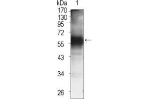 Western Blot showing TEC antibody used against TEC (aa90-240)-hIgGFc transfected HEK293 cell lysate (1). (NR4A3 抗体)