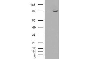 Image no. 2 for anti-Serine/threonine-Protein Phosphatase 4 Regulatory Subunit 3A (SMEK1) (Internal Region) antibody (ABIN375112) (SMEK1 抗体  (Internal Region))