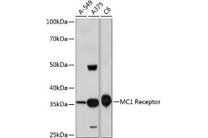 Western blot analysis of extracts of various cell lines, using MC1 Receptor Rabbit mAb  at 1:1000 dilution. (MC1 Receptor 抗体)
