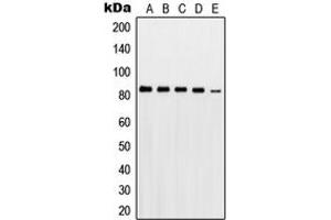 Western blot analysis of PKC gamma expression in HeLa (A), A431 (B), THP1 (C), mouse brain (D), rat brain (E) whole cell lysates. (PKC gamma 抗体  (Center))