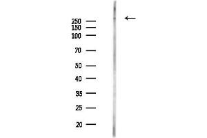 Western blot analysis of lysates from HUVEC cells(LPS,4h treatment), using Filamin B Antibody at 1/1000 dilution.