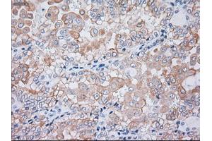 Immunohistochemical staining of paraffin-embedded liver tissue using anti-KRT19mouse monoclonal antibody. (Cytokeratin 19 抗体  (AA 240-390))