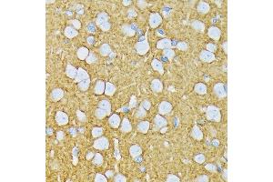 Immunohistochemistry of paraffin-embedded rat brain using GRIK2 Rabbit mAb (ABIN7267415) at dilution of 1:100 (40x lens). (GRIK2 抗体)