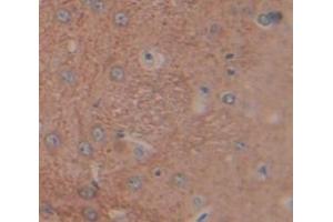 Used in DAB staining on fromalin fixed paraffin- embedded Kidney tissue (LCNL1 抗体  (AA 2-164))