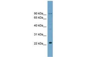 Image no. 1 for anti-Ribosomal L24 Domain Containing 1 (RSL24D1) (C-Term) antibody (ABIN6744099) (RSL24D1 抗体  (C-Term))
