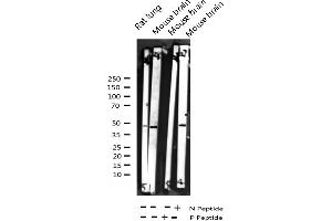 Western blot analysis of Phospho-p38 MAPK (Tyr182) expression in various lysates (MAPK14 抗体  (pTyr182))