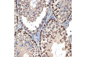 Immunohistochemistry of paraffin-embedded mouse testis using eIF3e Rabbit mAb (ABIN7267040) at dilution of 1:100 (40x lens). (EIF3E 抗体)