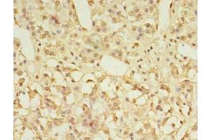 Immunohistochemistry of paraffin-embedded human adrenal gland tissue using ABIN7153339 at dilution of 1:100 (GPR3 抗体  (AA 300-330))