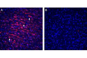 Expression of Tetraspanin-3 in rat cortex. (Tetraspanin 3 抗体  (Extracellular))