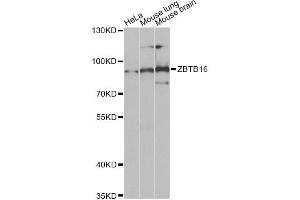 Western blot analysis of extracts of various cell lines, using ZBTB16 Antibody (ABIN5973474) at 1/1000 dilution. (ZBTB16 抗体)