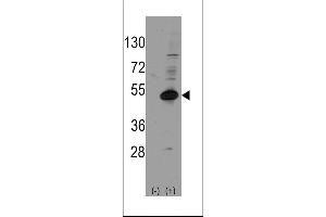 Western blot analysis of NROB1 (arrow) using rabbit polyclonal NROB1 Antibody (Human C-term) (ABIN389158 and ABIN2839324). (NR0B1 抗体  (C-Term))
